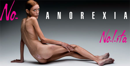 No Anorexia